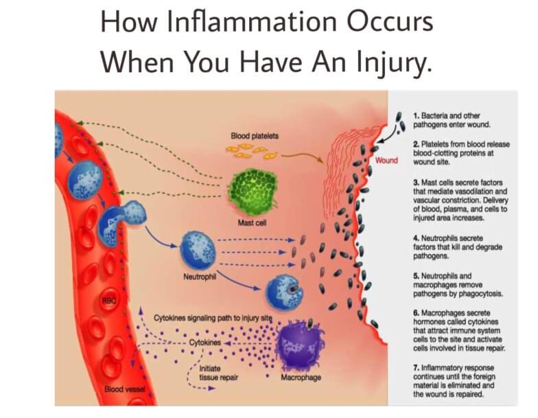 what causes inflammation?