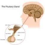 what are the diseases of the pituitary gland