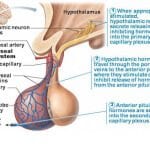 How Sheehan's Syndrome Happens