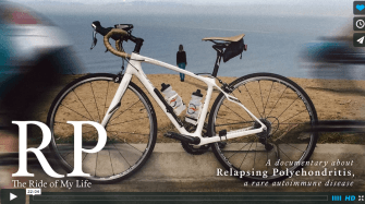 Rare Disease Relapsing Polychondritis Shared With Short Video