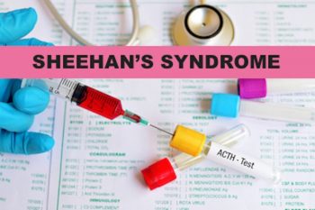 all about sheehans syndrome