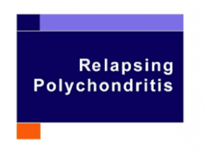 relapsing polychondritis treatments