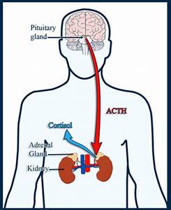 cushings syndrome symptoms