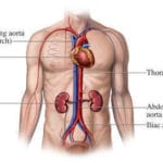 medical photo thoraic aorta