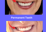 a review of the poorly placed implants by dr richard hada