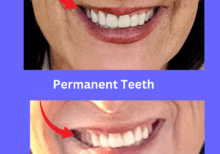 a review of the poorly placed implants by dr richard hada