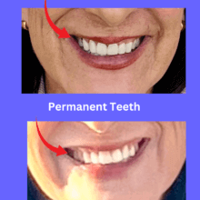 a review of the poorly placed implants by dr richard hada